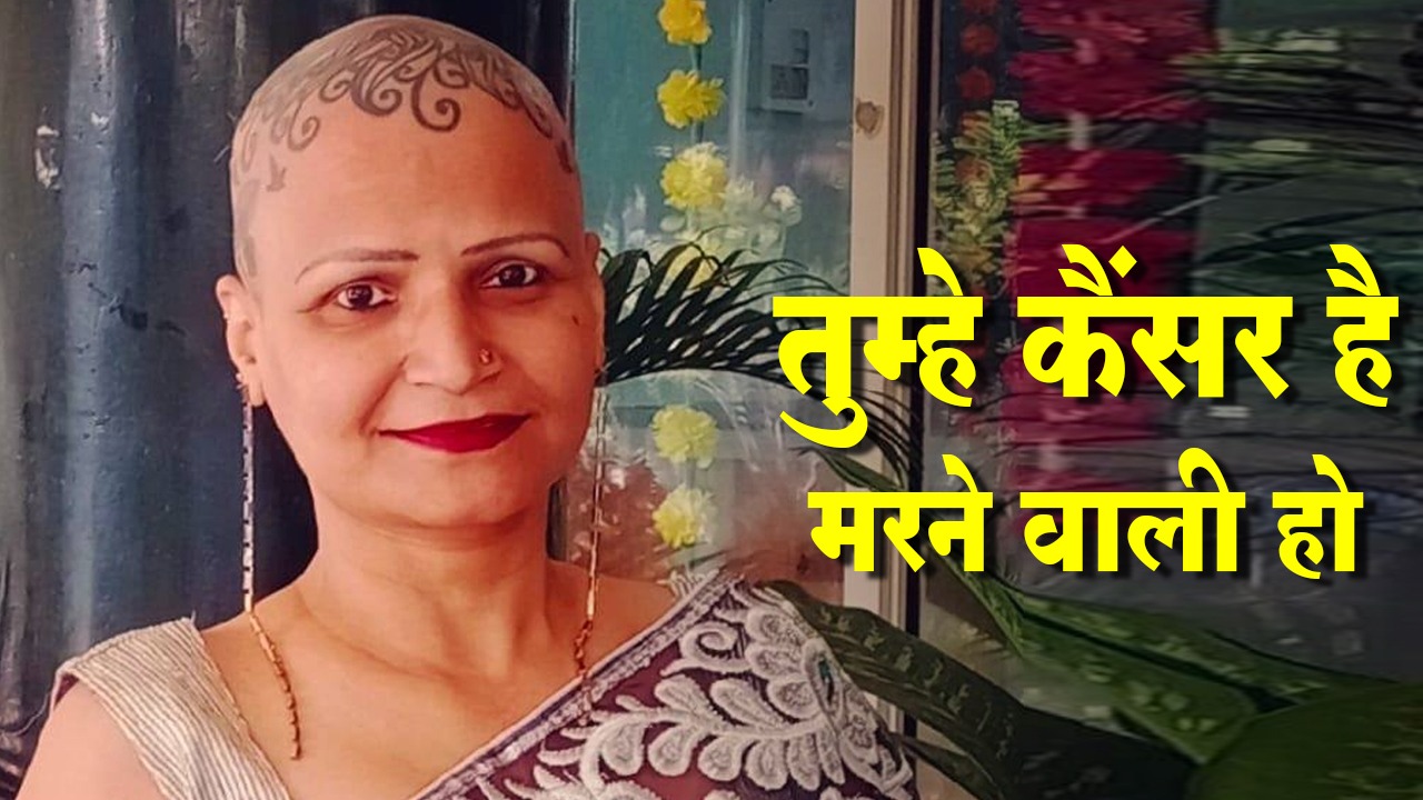 भारत की पहली Alopecia Survivor महिला की कहानी... जानें कौन हैं केतकी जानी